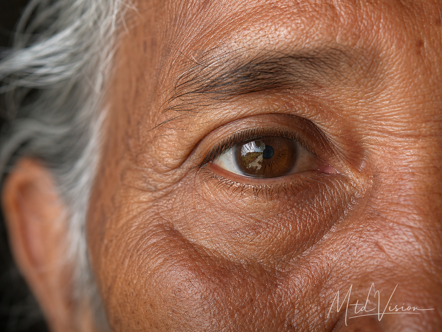 Eye.