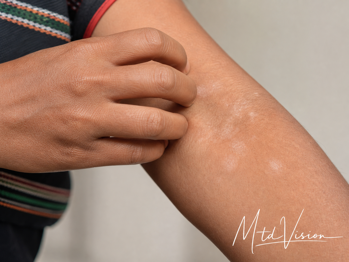 An unspecified skin condition causing itchy white spots.